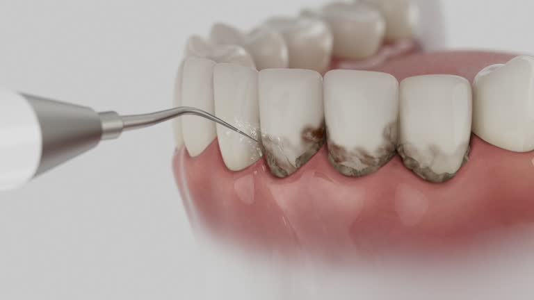 Reliable Dental contractor in Stockton, CA by Smile Center Dentistry
